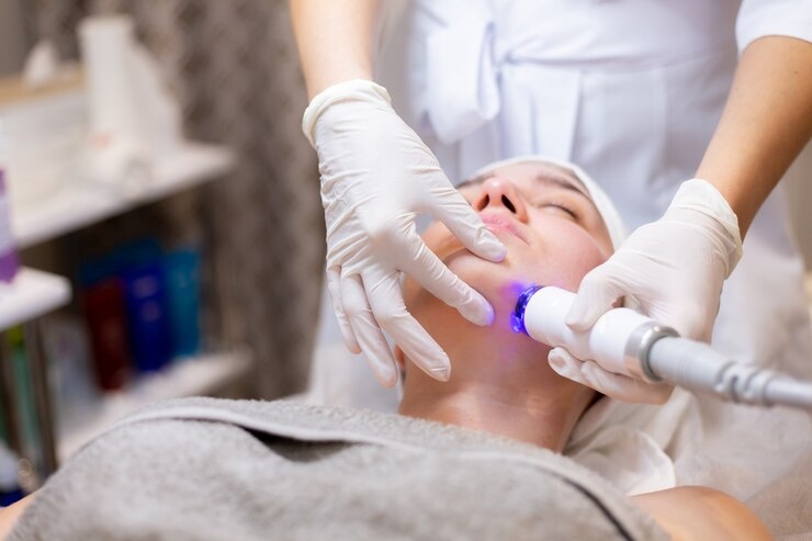 Fraxel Laser Treatment in Vancouver